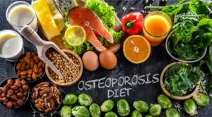 A variety of calcium and vitamin D-rich foods arranged to emphasize a diet beneficial for osteoporosis management